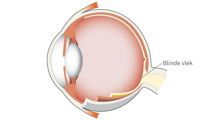 Blinde Vlek In Het Oog