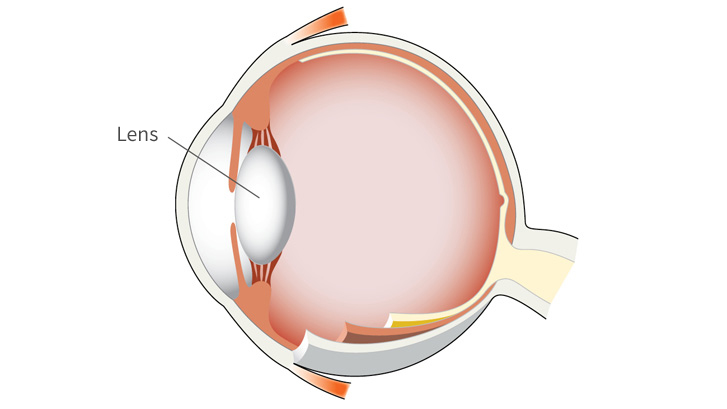De lens in het oog
