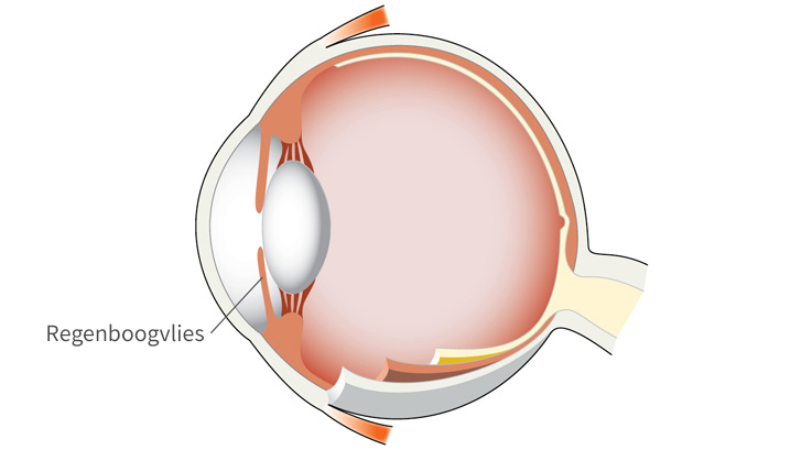 Regenboogvlies, iris