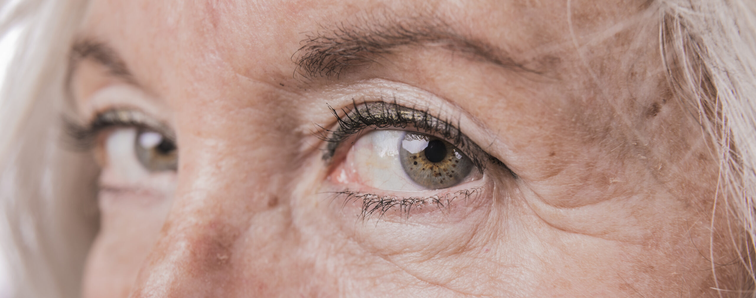 Is het resultaat van een lensvervanging blijvend?