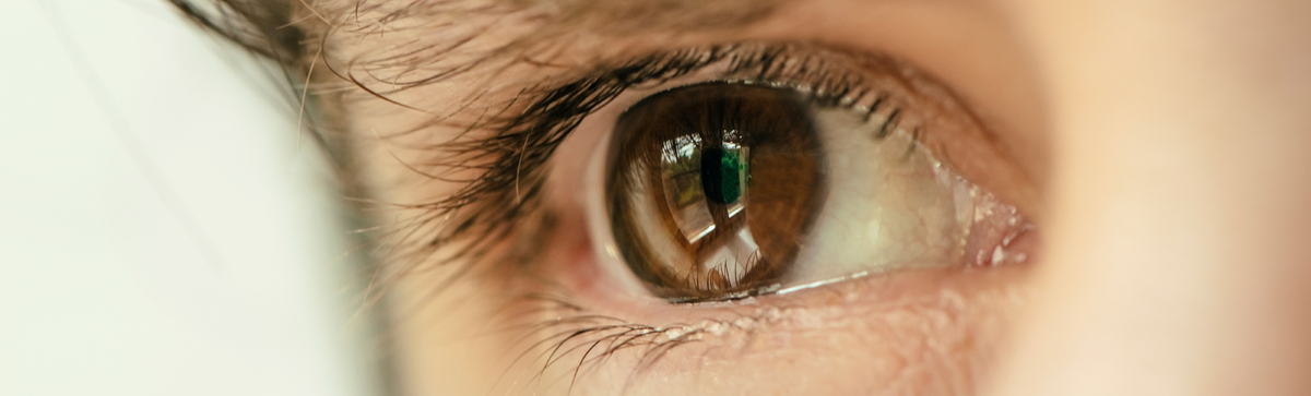 Astigmatisme – wat is het?